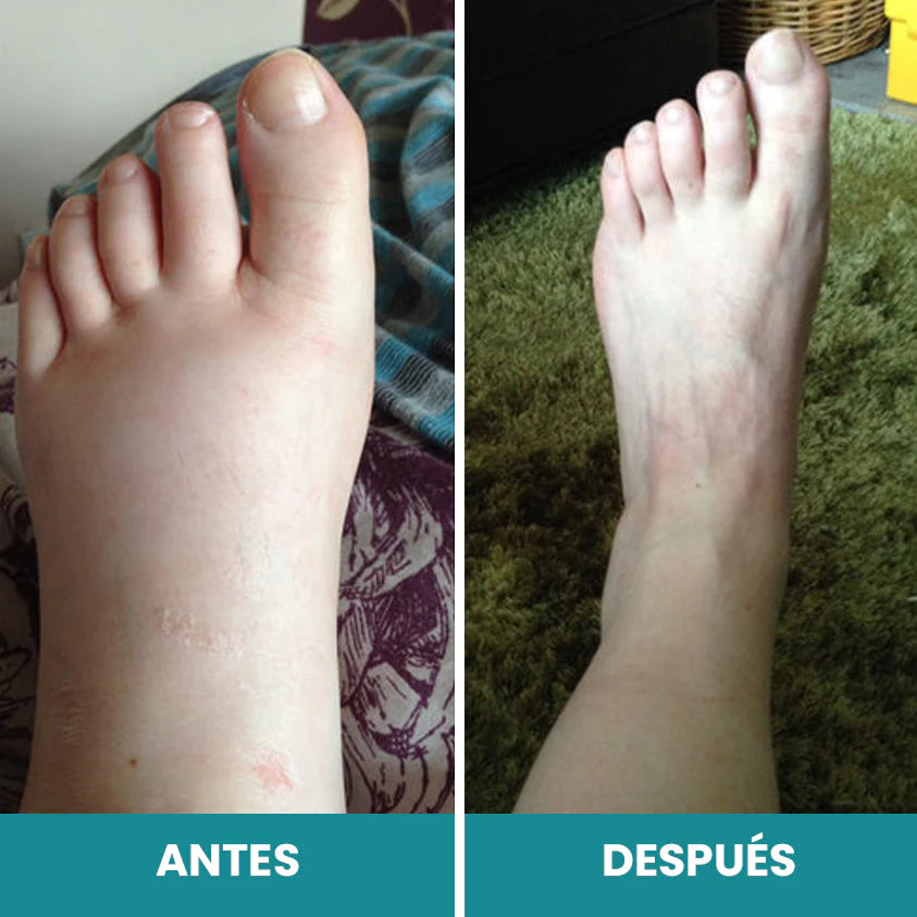 PulseStep - Pies sin dolor en minutos