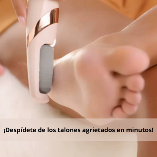 SoftFeet – Elimina callos y piel muerta desde la primera pasada