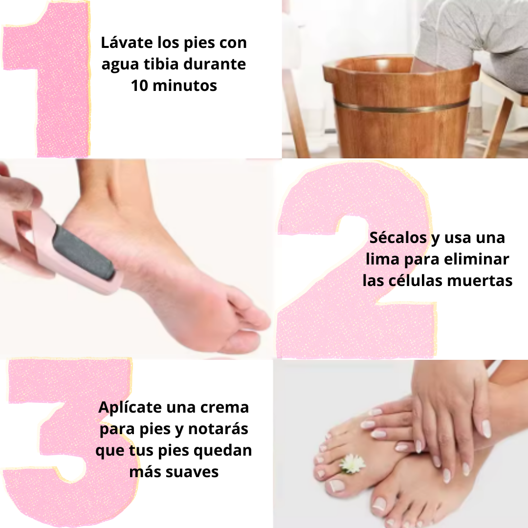 SoftFeet – Elimina callos y piel muerta desde la primera pasada