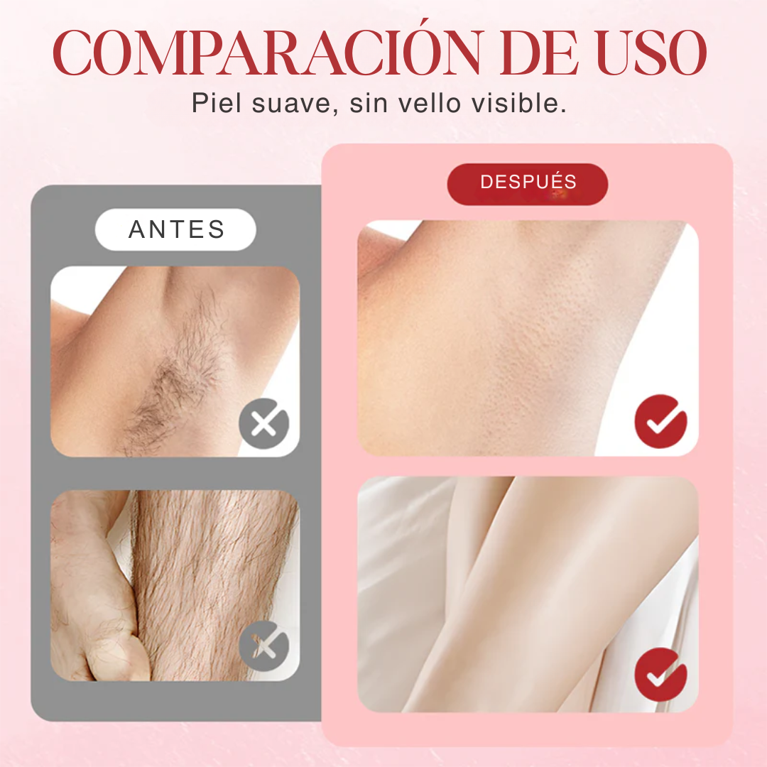 VelvetEdge – Piel suave sin dolor ni pelos encarnados